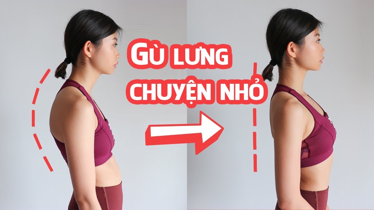 Bài tập đơn giản cải thiện tình trạng gù lưng phổ biến